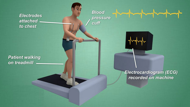 Exercise Stress Test